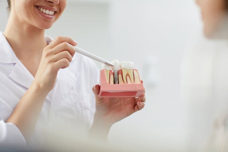 dentist pointing to a dental implant