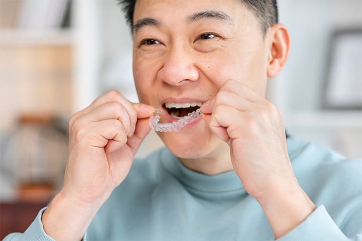 Invisalign patient in Weston putting in aligners.