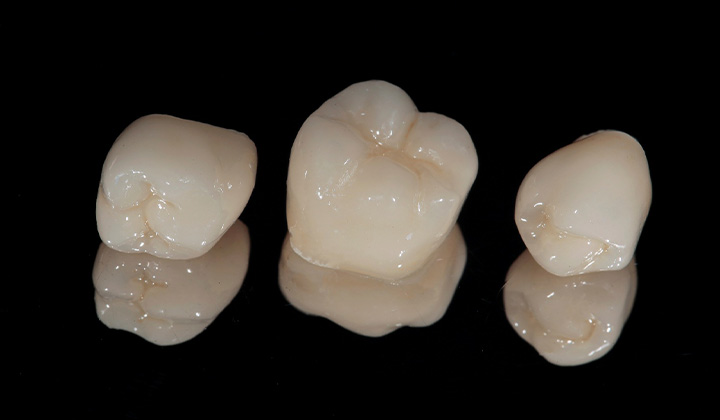 Dental crowns on a table at a Weston dental office.